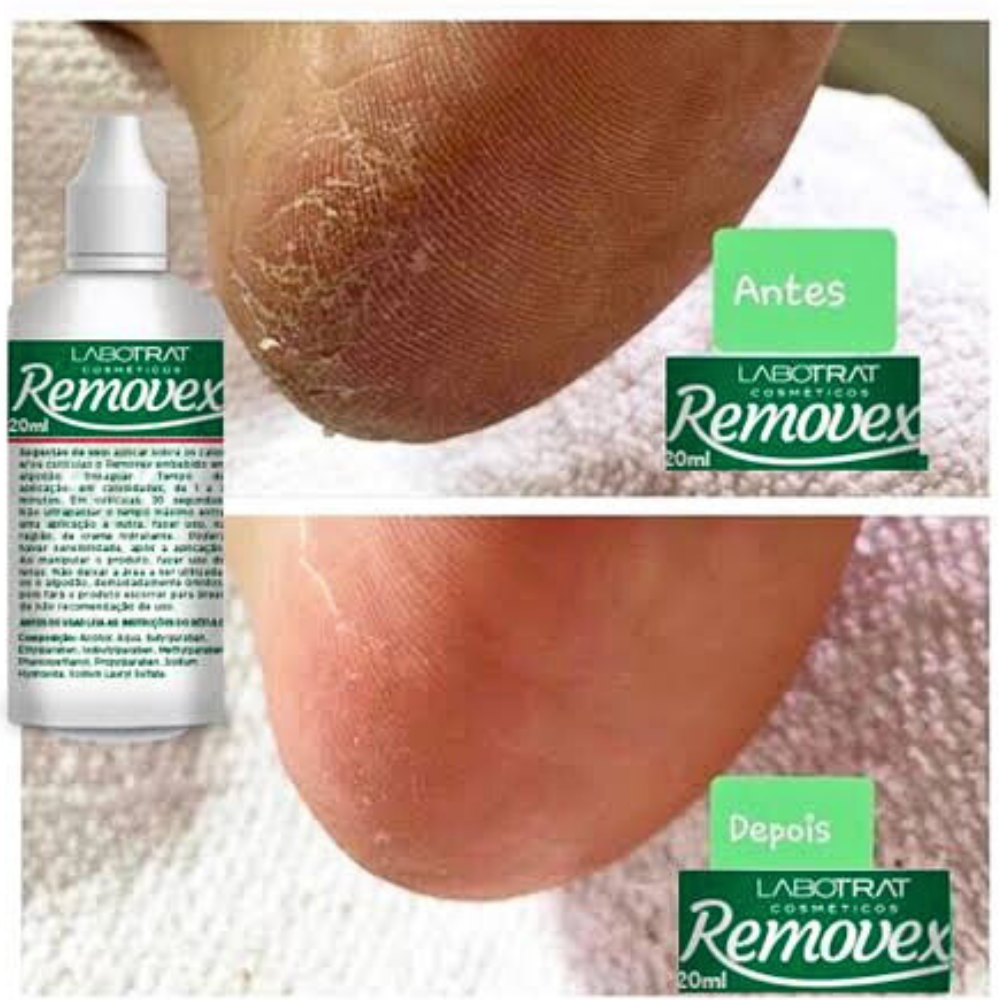 Removex Amaciante De Cutículas E Calosidades Labotrat 120ml