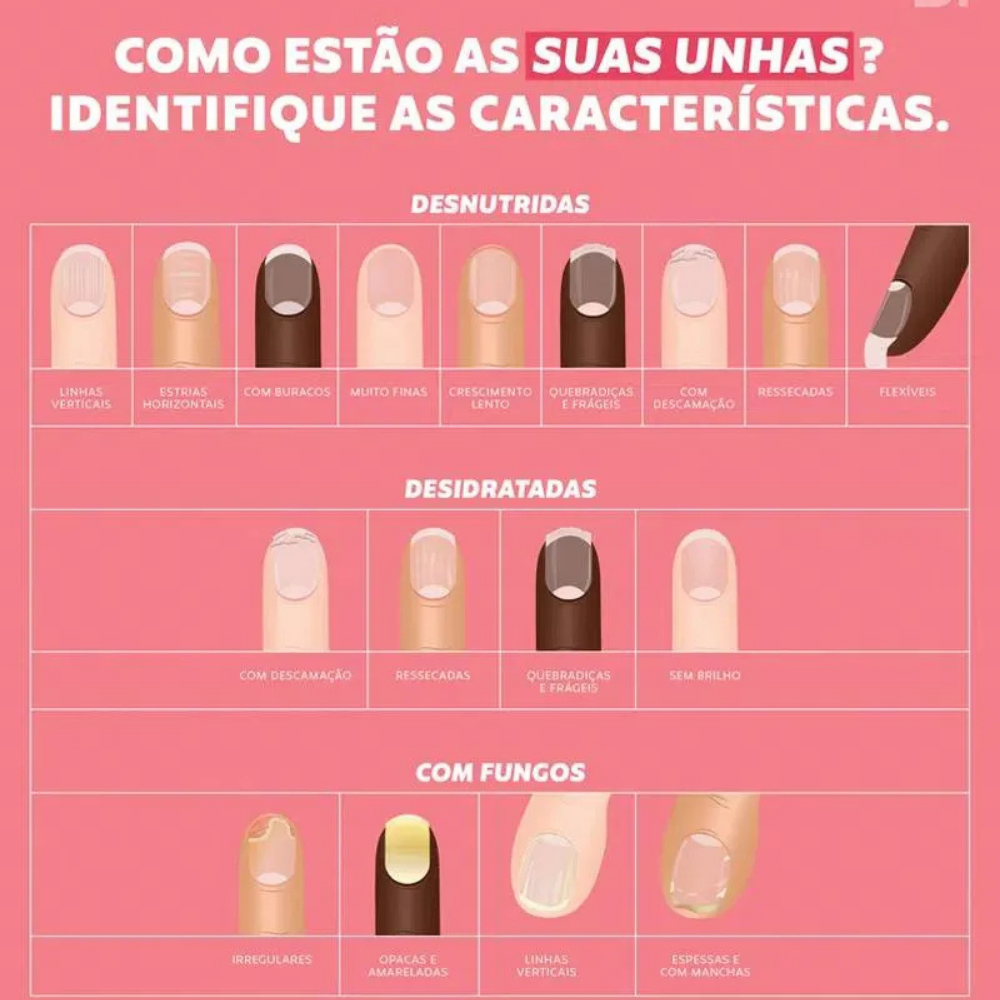 Base Crescimento Dailus Não Me Lasco Mais 8ml